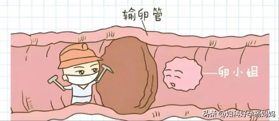 久备不孕，当心是输卵管“生锈了”！给你一张“孕通方”