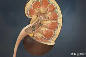 肾结石一直在复发，中医用一招“四合五”排石法，其实难度并不大图片