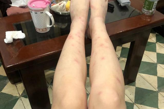 不是皮肤病，而是癌症预警？皮肤出现4种情况，建议早做检查