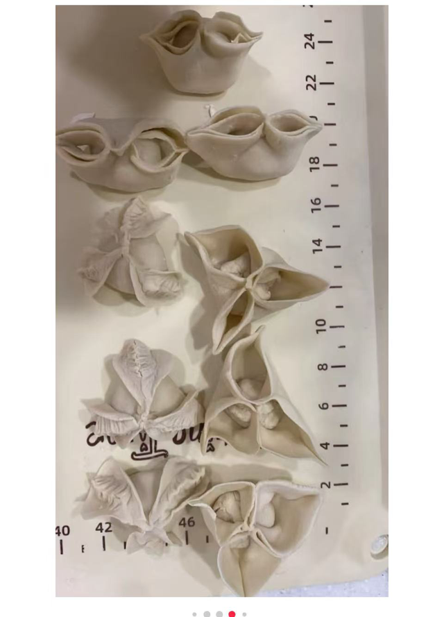 从18楼跳下的初中男孩，13天后在ICU醒来的第一句话，让我破防了