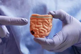 人不会无缘无故得肠炎！医生告诫：立夏后，不想得肠炎，注意4点图片