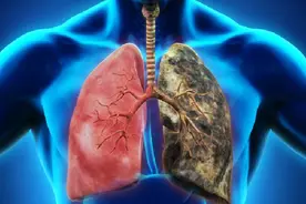 沉默杀手-慢阻肺，咳喘、呼吸困难、心肺衰竭！该怎么用药？图片