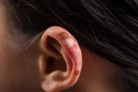 医生提醒：经常感到耳朵里面痒，或是这几种病的表现，别不当回事图片