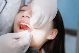 口腔拍片能查出什么病图片