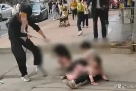 恶犬伤人事件后续：女童腿骨咬穿，救人男子发声，狗主人身份曝光图片