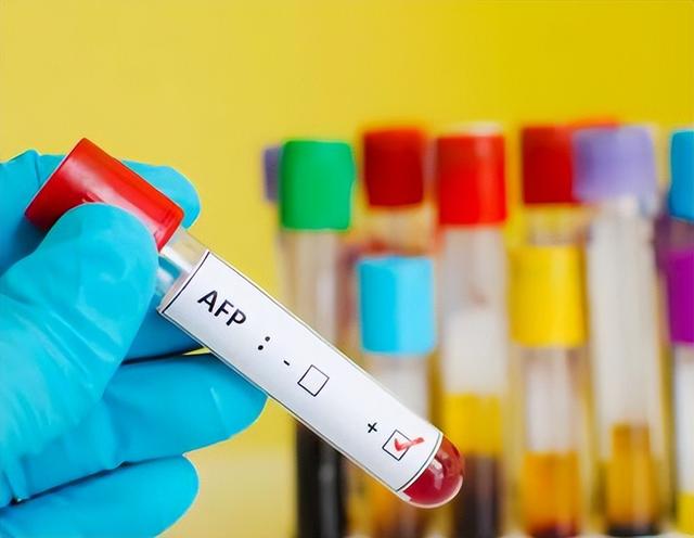 63岁男子皮肤瘙痒，以为是皮肤病，体检后	，医生叹：怎么不早来