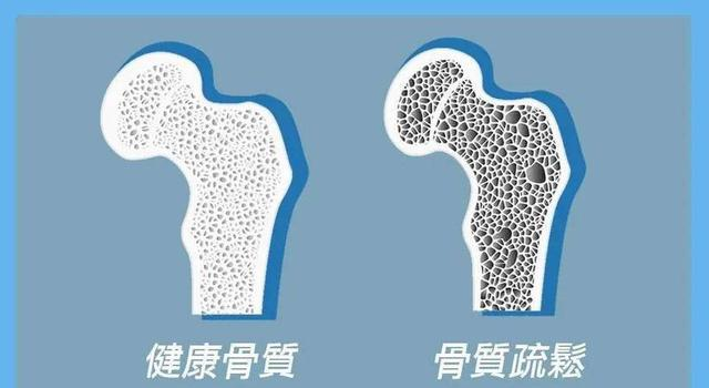 医生多次苦劝：过了65岁的人，宁可坐着休息，也别频繁做这4运动