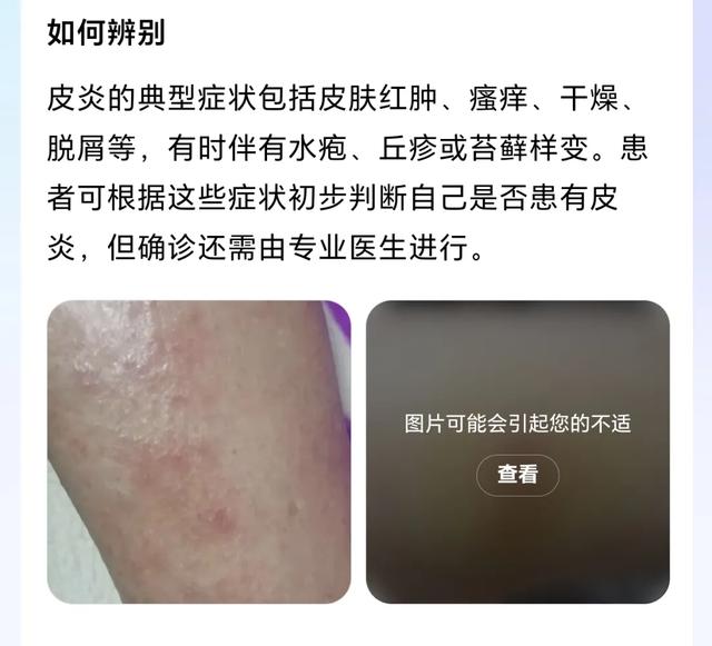 刚刚，百度健康推出7x24小时「能聊、有料、会管」AI管家