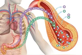 2型糖尿病背后真凶——胰岛素抵抗，一次给你讲清楚！图片