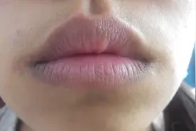 看嘴唇颜色 知道身体病症 你都了解么？图片