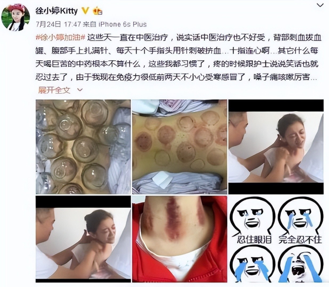 原来她早已去世！26岁全身溃烂不治而亡，被全家8口“吸血”多年