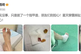 张雨绮拔了一个脚指甲 网友：隔着屏幕都觉得疼！图片