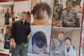 香港知名男星植发成功，割胆手术后身材消瘦，至今单身无儿无女图片