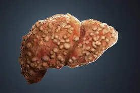 肝脏一旦生病，身体会出现7个信号暗示你，一定要特别重视！图片