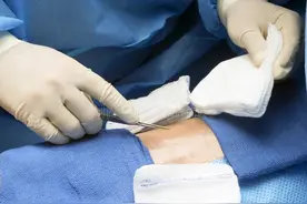 术后刀口疼痛之谜：当伤口愈合了，疼痛为何还在纠缠？图片