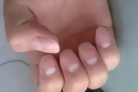 双手指甲盖上的月牙弯，反应身体的气血，月牙越多代表身体越健康图片