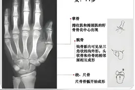 2025新版“骨龄身高对照表”，准确知道你家孩子将来能长多高图片