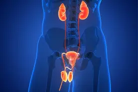 尿出肾结石，就“万事大吉”了吗？成都结石医院：事情没这么简单图片