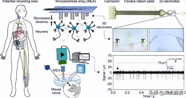 神经直读闯关成功！意念操控仿生假肢，千万截肢者迎来新希望
