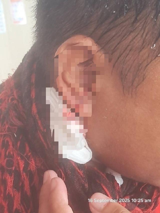 中国海警水炮左右夹击，菲方人员被喷成“一只耳”，挥舞白旗求饶