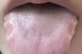 参苓白术散长期用，不仅脾胃好了，痰湿没了，气血足了，肾不虚了图片