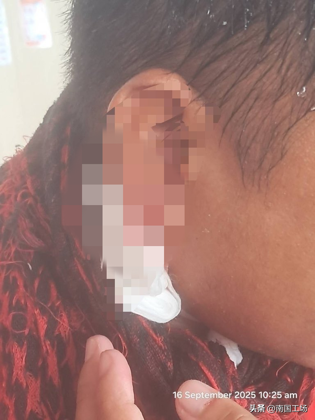黄岩岛大捷，菲律宾被打懵了：耳朵流血，举白色裤衩，向中方求饶