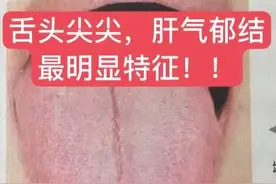 名老中医朱进忠舌诊用药经验真传图片