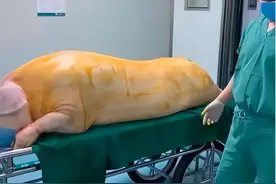 山东8岁女孩患怪病，为活命只能与猪“合体”，监控拍下揪心一幕图片