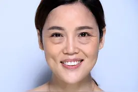 松弛？反弹？创口大？眼袋手术究竟能做吗？1分钟带你了解图片