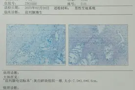 老年人晚上总想小便怎么办？泌尿外科医生告诉你解决办法图片