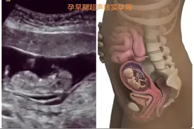 怀孕1-10个月，至少需要做几次超声检查。图片