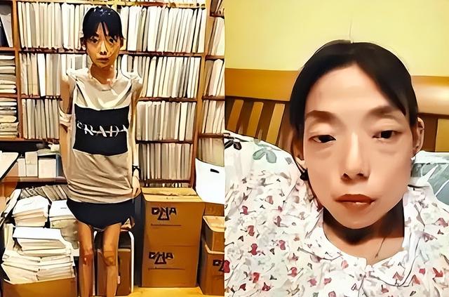 一代女神沦为豪门玩物？结婚8年牙齿全掉，器官切除，面似骷髅
