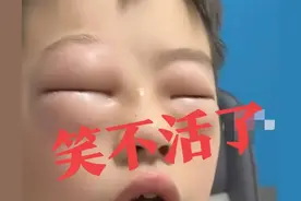 你敢信！河南一小孩写作业就过敏，妈妈：“不敢让他写作业了”图片