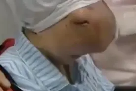 马面女孩吴小燕：纱巾蒙面13年，面部手术取出2公斤肿物后迎爱情图片