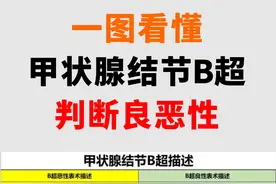 一图看懂：如何从甲状腺B超，判断结节的良恶性图片