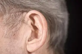 脑梗塞耳朵先知道？耳朵出现这2种现象，多半是脑血管的求救信号图片