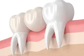 医生：作为家长，这些换牙的知识，你必须要掌握呀！图片