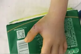 福建7岁女童被蛇咬，毒蛇潜藏玩具箱中！儿童被蛇咬伤如何自救？图片