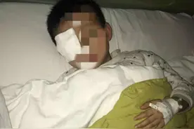 20分钟孩子眼球“溶化”！这东西每家都有，家长们一定要警惕图片