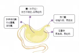 全！宝宝消化不良5大症状、4大原因、8大预防措施，一篇讲完！图片