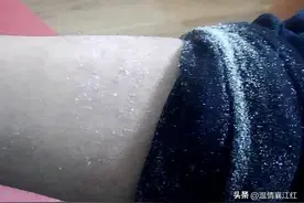 秋冬季腿部皮屑的“真凶”乃秋裤而非天气也！图片