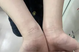 “电击、毒打、持枪威胁…我差点死在那里！”南充小伙讲述噩梦般的缅北经历图片