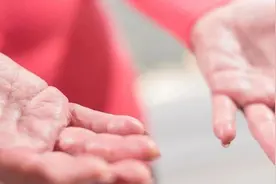 手脚心爱出汗是哪出问题了？5种情况提示疾病图片