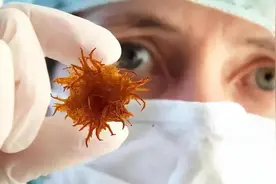 上海交大发现：体内有恶性肿瘤的人，身体一般或可能有7个表现图片