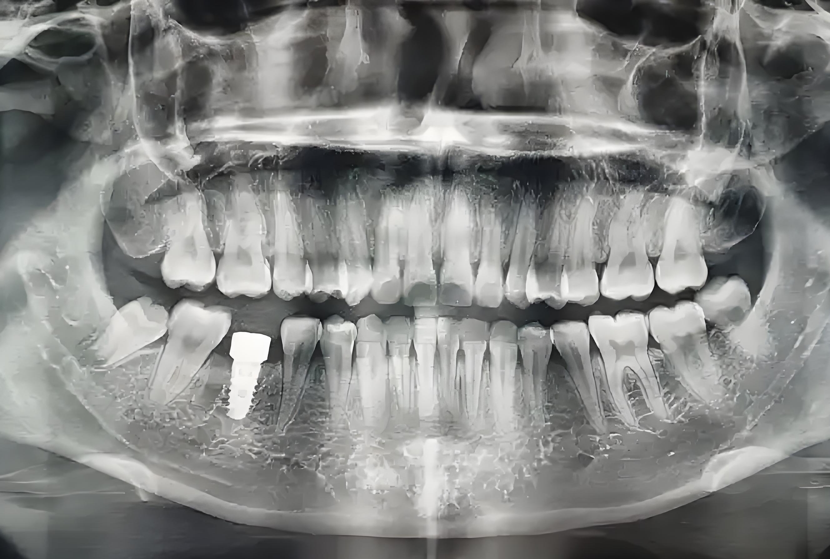 牙釉质修护再生硅牙膏护龈健齿配奢侈风金属柄牙刷,坏牙佬有救了