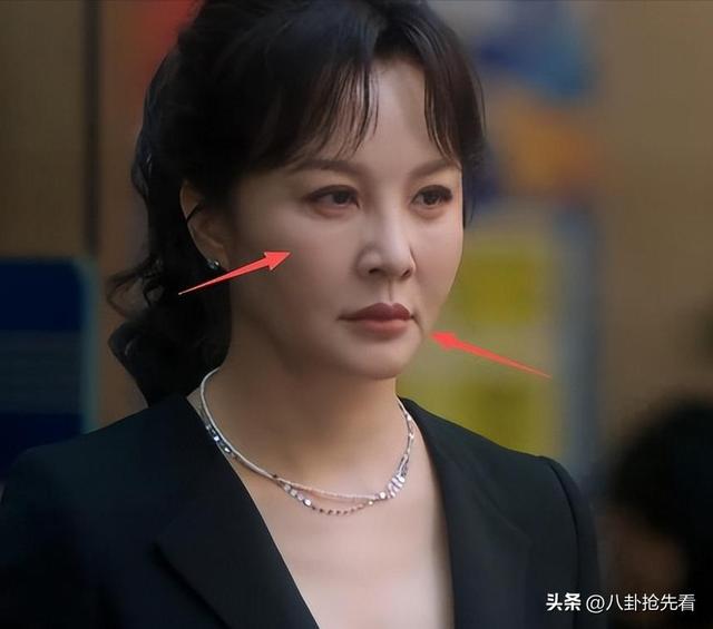 “整容脸”别来祸害央视剧！发面馒头、青蛙眼	，实在让人难以入戏