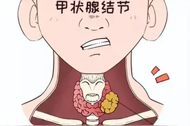 有结节要少吃香蕉？因这3个原因！有6种水果也少吃，过年也要节制图片