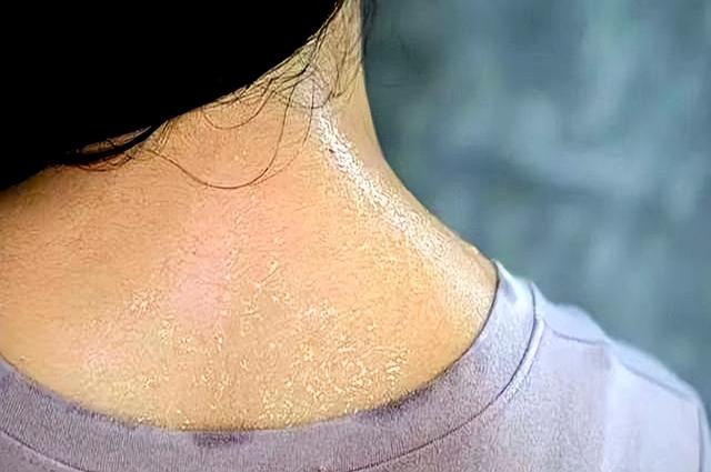 海南一名年仅33岁女性！在持续高温下坚持户外晨跑，回家后倒地