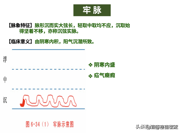 中诊入门：浮、散、革、芤脉，沉脉对比伏、牢脉，文末附《指法》