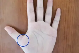 手掌青筋不退，竟然是血管在报警！图片
